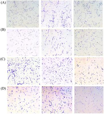 Isolation and identification of probiotic Bacillus subtilis AJQ03 from the intestinal tract of Anguilla japonica (Japanese eel)